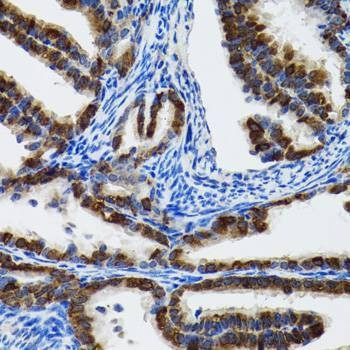 Anti-HSPH1 Antibody
