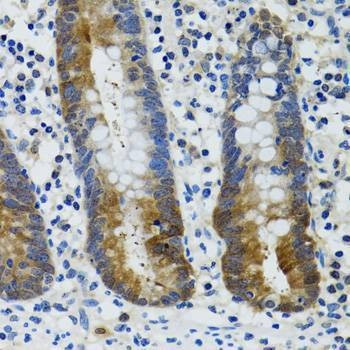 Anti-HSPH1 Antibody