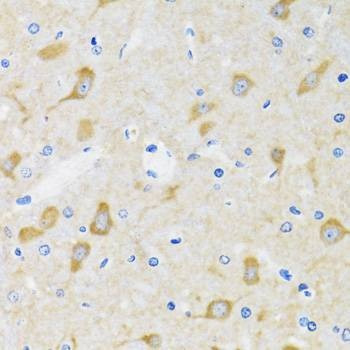 Anti-HSPH1 Antibody