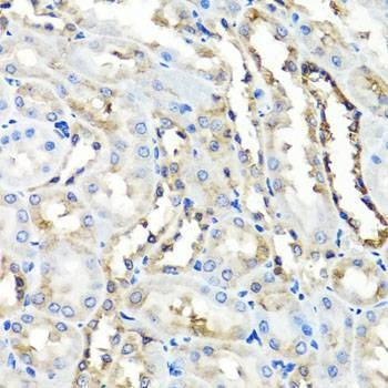 Anti-HYAL1 Antibody
