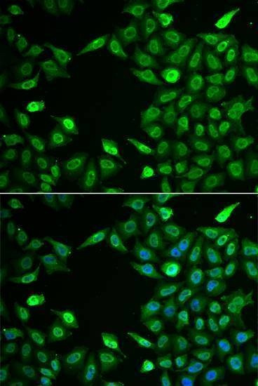 Anti-INTS6 Antibody