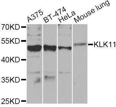 Anti-KLK11 Antibody