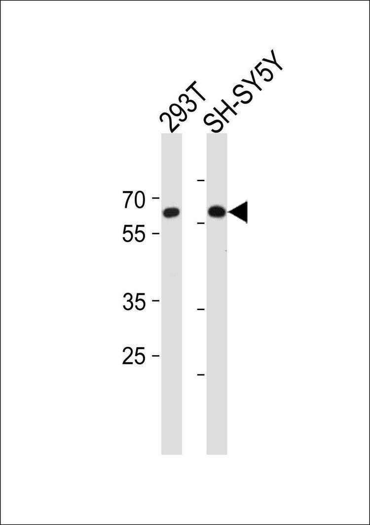 Anti-IRX3 (N-term) Antibody
