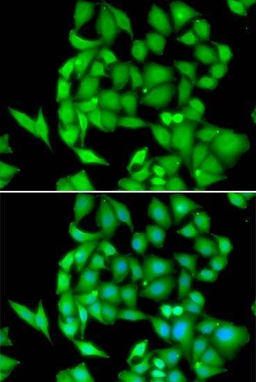 Anti-NEK3 Antibody