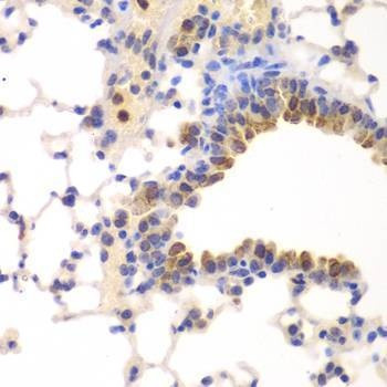Anti-NFKB1 Antibody