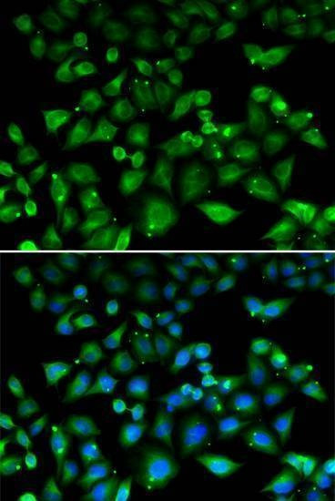 Anti-NHLRC1 Antibody