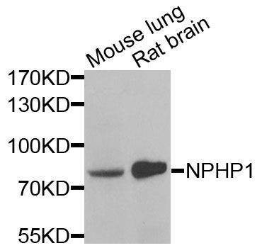 Anti-NPHP1 Antibody