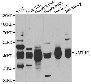 Anti-NSFL1C Antibody