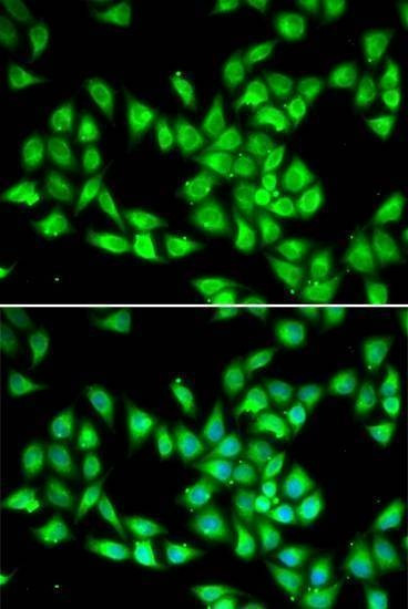 Anti-PCMT1 Antibody