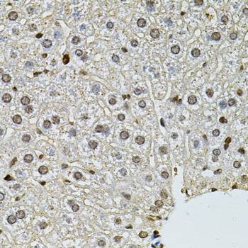 Anti-PNKP Antibody