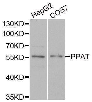Anti-PPAT Antibody
