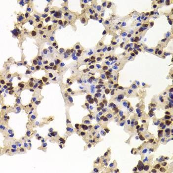 Anti-PPAT Antibody