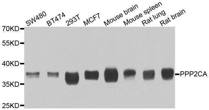 Anti-PPP2CA Antibody