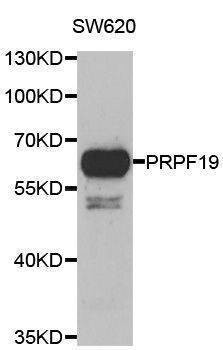 Anti-PRPF19 Antibody