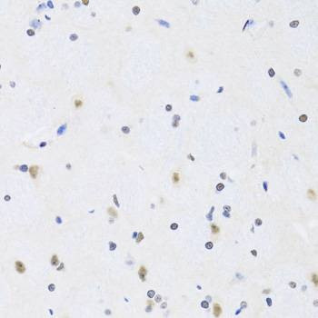 Anti-PRPF19 Antibody