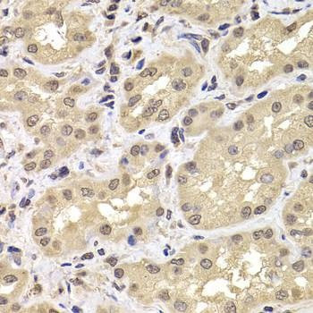 Anti-PSMD12 Antibody