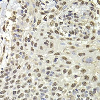 Anti-PUF60 Antibody