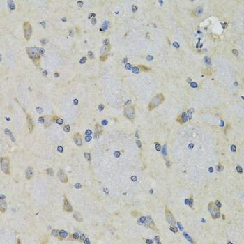 Anti-RAE1 Antibody