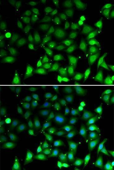 Anti-RAE1 Antibody