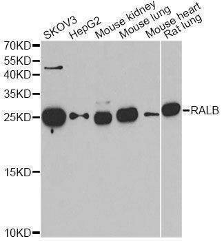 Anti-RALB Antibody