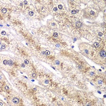 Anti-RALB Antibody