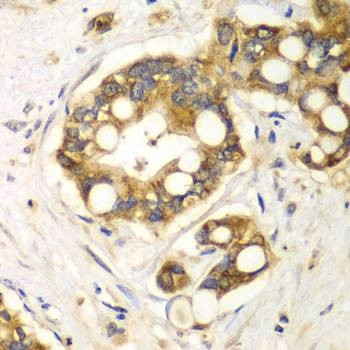 Anti-RPH3A Antibody