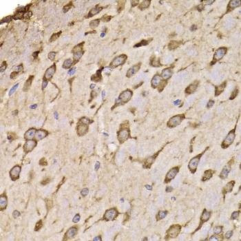 Anti-RPS14 Antibody