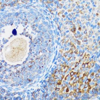 Anti-SMPD1 Antibody