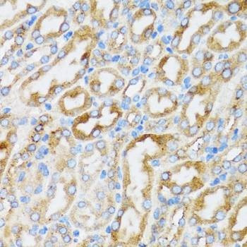 Anti-SMPD1 Antibody