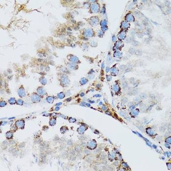 Anti-SMPD1 Antibody