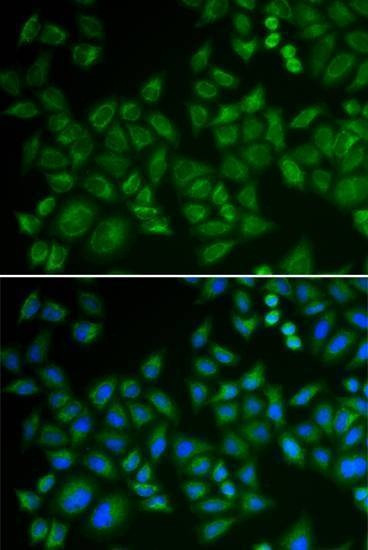 Anti-SMPD1 Antibody