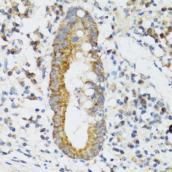 Anti-SRP19 Antibody