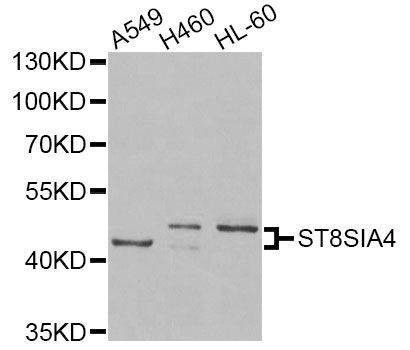 Anti-ST8SIA4 Antibody