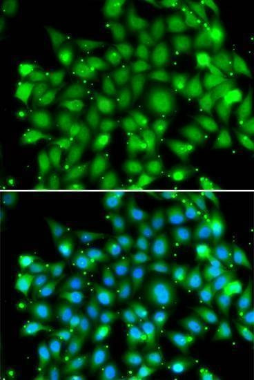 Anti-SUFU Antibody