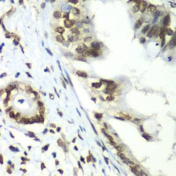 Anti-TEAD1 Antibody