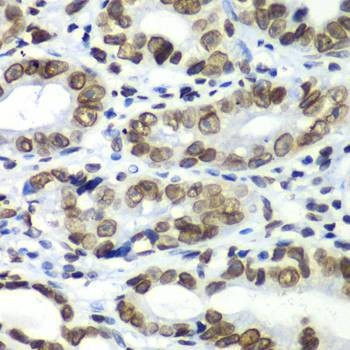 Anti-TEAD1 Antibody