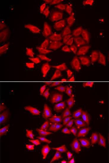 Anti-TMOD4 Antibody