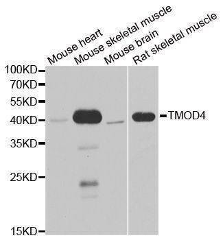 Anti-TMOD4 Antibody