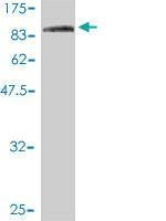 Anti-COG7 Antibody