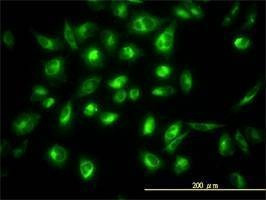 Anti-COG7 Antibody