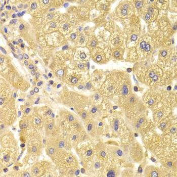 Anti-TRAF3IP2 Antibody