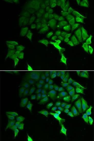 Anti-TSC22D3 Antibody