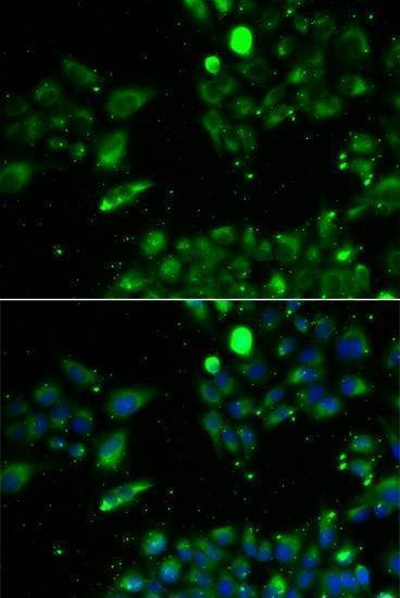 Anti-UQCRFS1 Antibody