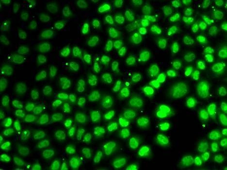 Anti-XPO5 Antibody