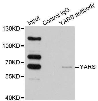 Anti-YARS Antibody