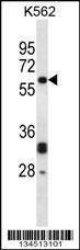 Anti-NMT2 (C-term) Antibody