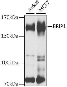 Anti-BRIP1 Antibody