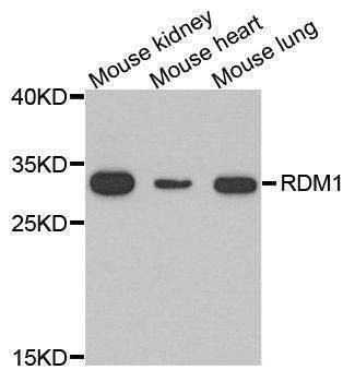 Anti-RDM1 Antibody