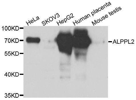 Anti-ALPPL2 Antibody