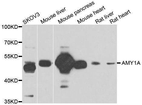Anti-AMY1A Antibody